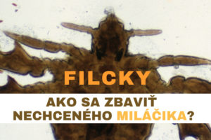 filcky