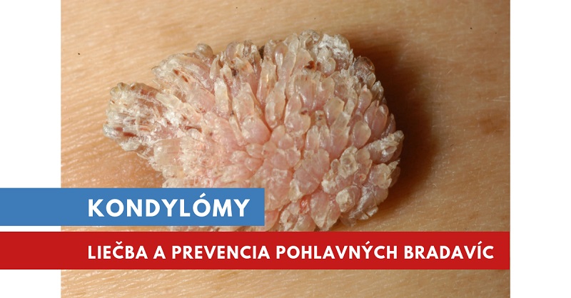 hpv bradavice krém)