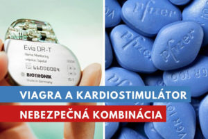 Viagra a kardiostimulátor