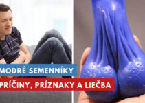 modré semenníky