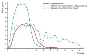 uroflowmetrická krivka