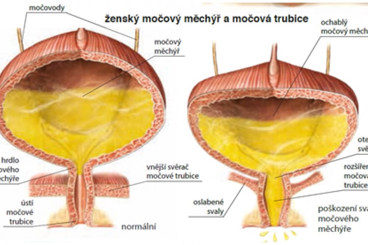 schéma močového mechúra