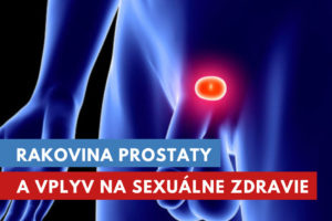 rakovina prostaty a sexuálny život