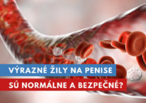 výrazné žily na penise