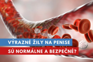 výrazné žily na penise