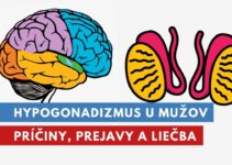 hypogonadizmus u mužov