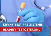 testosterón test