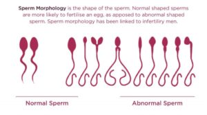 normálna morfológia spermií