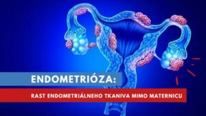 endometrióza