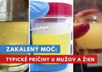 zakalený moč